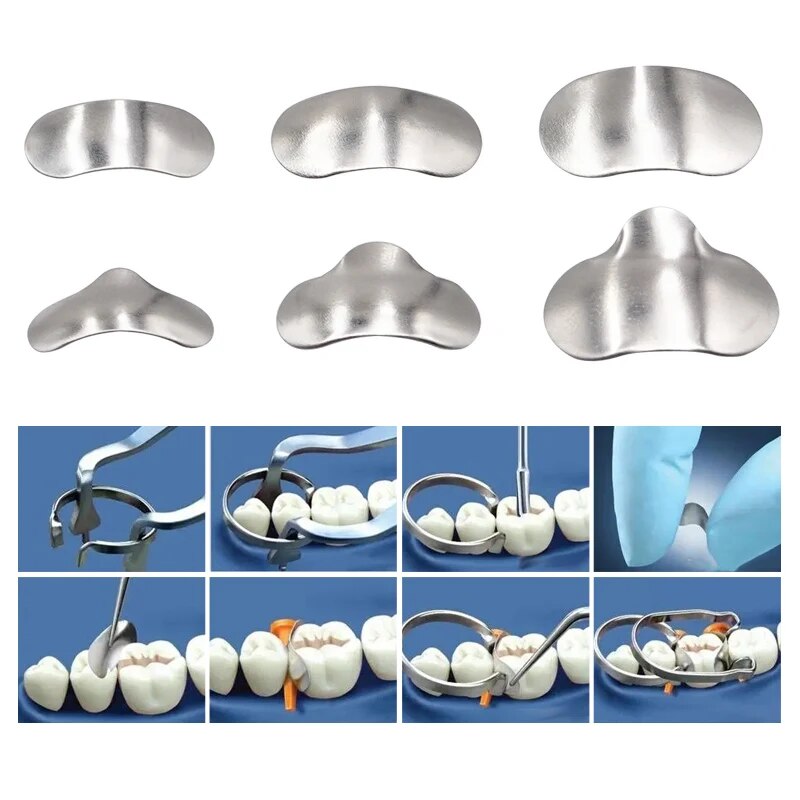100Pcs/Box Dental Sectional Ma - đánh giá và giá Resin Art Case